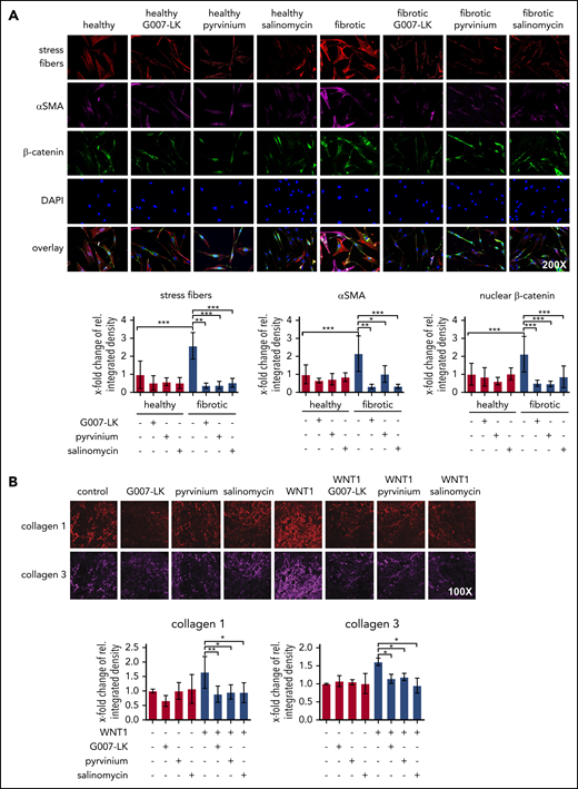 The WNT pathway regulates fibroblast activation. (A) Representative images of immunofluorescence staining for stress fibers, αSMA, and β-catenin in human dermal fibroblasts, with and without WNT inhibitors (original magnification ×200). Quantifications indicate that treatment with WNT inhibitors (24-hour incubation) prevents the upregulation of stress fiber formation, αSMA expression, and β-catenin accumulation in fibroblasts. (B) Representative pictures and quantifications of immunofluorescence staining for collagen type I and III in decellularized extracellular matrixes in human fibroblasts with or without WNT1 and with or without WNT inhibitors (48-hour incubation) (n = 4 cell lines each) (original magnification ×100). *P < .5; **P < .05; ***P < .01.