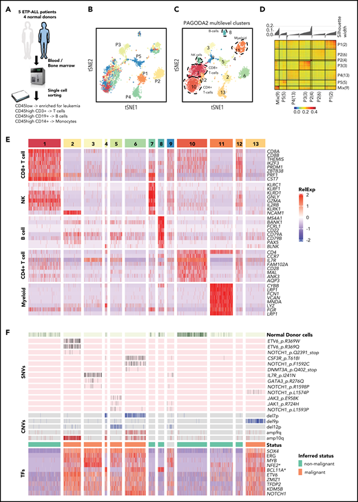 ETP-ALL cells have distinct transcriptional profile. (A) Schematic depicting the cohort, sample collection, processing and sorting of cells for single-cell transcriptional profiling using SMART-seq2 protocol. (B) t-SNE of the processed single-cell RNA-seq gene expression data reveals distinct patient-specific clusters along with heterogeneous clusters. (C) Clusters were further analyzed using PAGODA2 to identify the cell type of individual cells. (D) Correlation distance matrix (1-Pearson correlation coefficient) derived from normalized gene expression values of individual malignant cells. The silhouette plot on top of the matrix depicts the uniqueness of each of the patient-specific malignant clusters. (E) Marker gene analyses identify heterogeneous clusters as CD4+ T cells, CD8+ T cells, natural killer (NK) cells, B cells, and myeloid cells. Expression of the top marker genes for each of the clusters containing normal cells is depicted as heatmap. (F) Cells from normal donors are highlighted in the heatmap (top) and fall into normal cell clusters. Malignant clusters identified by calling of those pathogenic variants (SNVs and CNVs) in single cells that were identified in individual patients by clinical targeted sequencing (middle; Table 1). Expression of transcription factors (TFs) distinguishing malignant cells from nonmalignant cells sequenced in this study (as inferred from random forest model). *NFE2 was ranked lower when only untreated leukemic cells were used to build the model, whereas *BCL11A was ranked higher.
