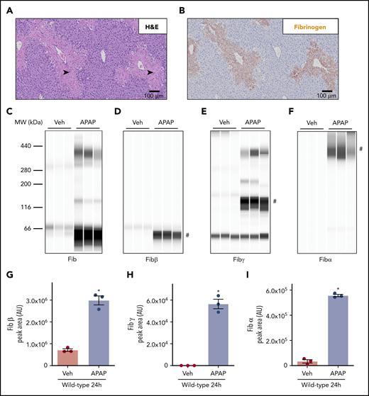 Deposition of cross-linked fibrin(ogen) in livers of mice after APAP overdose. WT mice were treated intraperitoneally with saline vehicle (Veh) or 300 mg/kg APAP, and hepatic fibrin(ogen) levels were determined 24 hours after challenge. (A-B) Representative photomicrographs (200×) show H&E-stained (A) and fibrin(ogen)-labeled (B, brown) liver sections. Necrosis denoted by black arrowhead. (C-I) Fibrin(ogen) levels were measured in enriched insoluble liver extracts using capillary-based western blotting (Wes). (C-F) Digital capillary images show fibrin(ogen) detected by rabbit polyclonal antibodies against fibrinogen (C) and selective for fibrin(ogen) Bβ (D), γ (E), and Aα chains (F). (G-I) Quantification of peaks indicated by the # in panels D-F is shown (n = 3 mice/group). Data are expressed as mean ± standard error of the mean. *Significantly (P < .05) different from saline-treated mice.