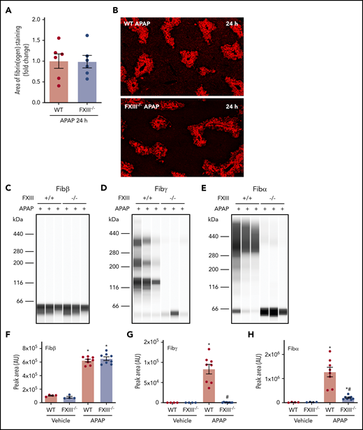 Impact of FXIII deficiency on hepatic fibrin(ogen) cross-linking after APAP overdose. FXIII−/− mice and WT mice were treated intraperitoneally with saline vehicle or 300 mg/kg APAP. Livers were collected 24 hours after challenge. (A) Fibrin(ogen) labeling in frozen liver sections was quantified as described in previously (n = 6 mice/group). (B) Representative photomicrographs of fibrinogen-labeled frozen sections (×5 virtual magnification). Fibrin(ogen) levels were measured in enriched insoluble liver extracts using capillary-based western blotting (Wes). (C-E) Representative digital capillary images show fibrin(ogen) detected and quantified (D-F) by rabbit polyclonal antibodies selective for fibrin(ogen) Aα, Bβ, and γ chains. n = 4 mice for vehicle-treated groups and 8 mice for APAP-challenged groups (F-H). Data expressed as mean ± standard error of the mean. *Significantly (P < .05) different from saline-treated mice of the same genotype. #Significantly (P < .05) different from APAP-challenged WT mice.