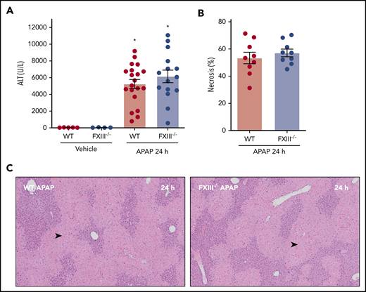 Impact of FXIII deficiency on liver injury after APAP overdose. FXIII−/− mice and WT mice were treated intraperitoneally with saline vehicle or 300 mg/kg APAP, and liver and citrated plasma were collected 24 hours after APAP challenge. (A) Plasma ALT activity was determined using commercial reagents (n = 4-5 mice/group for vehicle treated and 15-20 mice/group for APAP challenged). (B) Area of centrilobular necrosis was quantified as described (n = 9 mice/group). (C) Representative photomicrographs of H&E-stained liver sections (necrosis denoted by black arrowhead). Data expressed as mean ± standard error of the mean. *Significantly (P < .05) different from vehicle-treated mice of the same genotype.