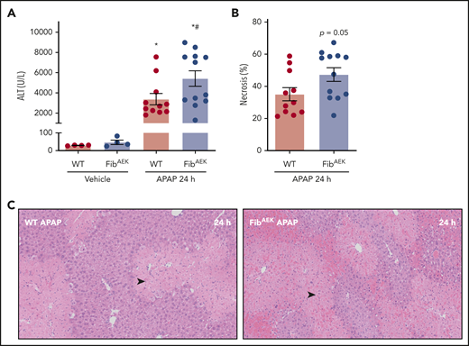 Role of thrombin-driven fibrin polymer formation in liver injury after APAP overdose. Mice expressing mutant fibrinogenAEK (FibAEK mice) and WT mice were treated intraperitoneally with saline vehicle of 300 mg/kg APAP and liver and citrated plasma were collected 24 hours after challenge. (A) Plasma ALT activity was determined using commercial reagents (n = 4 mice/group for vehicle treated and n = 11-12 mice/group for APAP challenged). (B) Area of centrilobular necrosis was quantified (n = 11-12 mice/group). (C) Representative photomicrographs of H&E-stained liver sections (necrosis denoted by black arrowhead). Data expressed as mean ± standard error of the mean. *Significantly (P < .05) different from vehicle-treated mice of the same genotype at 24 hours. #Significantly (P < .05) different from APAP-challenged WT mice.