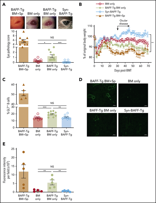 Persistent excess BAFF after allo-BMT promotes cGVHD manifestations, GL7+ B cells, and antirecipient antibody production. (A) Ocular cGVHD manifestations in recipients of T cell–depleted WT BM, BAFF Tg BM, or Syn-BMT. Representative photographic examples of eye pathology via Zeiss Stemi 2000-C stereo microscope with Nikon Coolpix P5100 camera (×3.2 magnification) are shown above the graph of the compiled cGVHD eye pathology scores. Eye scores include chemosis, mucoid discharge, and corneal opacity as assessed by biomicroscopic examination by a masked investigator at day 35 after allo-BMT. Data shown are from 1 representative experiment of 3 independent repeats; n = 10 each group (BM only and Syn groups). For reference, scores for the T cell–replete BAFF Tg BM + Sp are shown in the column on the far left; n = 9 (BAFF Tg BM + Sp). (B) Relative body weights in recipients of BM only T cell–depleted BAFF-Tg vs WT donor cells vs Syn BAFF Tg BM only cells; n = 5 (Syn-BMT) and n = 10 for other groups. This experiment was repeated, and data shown are representative of 2 experiments. (C) Frequency of GL7+ peripheral blood B cells in recipients of T cell–depleted WT BM, BAFF Tg BM, or Syn-BMT as assessed by flow cytometry on day 61 after allo-BMT. We quantified the proportion of GL7+ cells after pre-gating on Zomibie−CD19+ live cells in blood from allo-BMT mice using T cell–depleted BAFF Tg BM only vs WT BM only cells or Syn BAFF Tg BM only. This experiment was repeated 3 times, with each producing similar results; n = 5 (BAFF Tg BM + Sp) and n = 10 for all other groups. Similar results (data not shown) were also found on day 137 after allo-BMT in the above experiment. (D) Representative immunofluorescent images showing the relative amounts of plasma IgG taken after BMT bound to salivary gland tissue sections from BALB/c RAG−/− mice. Donor-derived antirecipient IgG after allo-BMT from recipient of T cell–depleted BAFF Tg BM ± Sp vs T cell–depleted WT BM only transplants and Syn BAFF Tg BM only is detected with an anti-mouse IgG- Alexa Fluor 488 secondary antibody. Images were taken by Zeiss Axiovert 200M fluorescence microscope with ApoTome using 200× lenses. (E) Relative fluorescence intensity of the plasma IgG-stained BALB/c RAG−/− salivary gland tissue sections shown in panel D quantitated using ImageJ software. The integrated intensity value measured by ImageJ per image field is shown as mean fluorescence intensity. Plasma from 2 mice of each group was assessed, with 2 to 3 images taken from each slide. Each symbol represents fluorescence intensity of a single image. This quantification strategy was repeated twice. Statistical analysis was performed by Kruskal-Wallis test (A), repeated measures analysis of variance (ANOVA) of body weight data from day 20 to 70 (B), or ordinary 1-way ANOVA with Tukey’s multiple comparisons test (C-E) using GraphPad Prism 8 software. *P < .05, **P < .01, ***P < .001. NS, not significant (P > .05).