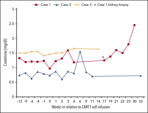 Serum creatinine levels in relation to CAR T-cell infusion. The horizontal axis represents time (weeks) in relation to CAR T-cell infusion, and the vertical axis represents serum creatinine value. Baseline serum creatinine in cases 1, 2, and 3 were 1.20, 0.74, and 1.53 mg/dL, respectively, at time of CAR T-cell infusion. Case 1 developed AKI at week 21 that was attributed to possible acute graft rejection (Banff classification; i1,t1 v0, g0, ptc 0, c4d0, cg0, mm0, ah2, cv1, ci 0, and ct0). His dd-cfDNA level increased from 0.55% to 4.6% at week 16 with no detectable DSA. Repeat DSA at week 28 was positive. Case 3 kidney function remained stable throughout the therapy, and case 2 developed AKI at week 7 that was attributed to hypovolemia and resolved with fluid resuscitation. ah, arteriolar hyalinosis; AKI, acute kidney injury; ci, interstitial fibrosis; ct, tubular atrophy; cv, vascular fibrous intima thickening; DSA, donor-specific antibodies; i, interstitial inflammation; g, glomerulitis; mm, mesangial matrix expansion; ptc, peritubular capillaritis; t, tubulitis; v, arteritis.