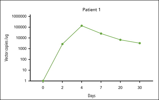 CAR T-cell expansion in peripheral blood in patient 1. The horizontal axis represents time (days) in relation to CAR T-cell infusion, and the vertical axis represents vector copies per microgram of buffy coat DNA. We quantified the integrated genome of the retrovirus encoding the anti-CD19 CAR (axi-cel) by quantitative PCR.8 DNA was extracted from buffy coat samples with DNeasy Blood and Tissue Kit (Qiagen) as per the manufacturer’s instructions. DNA was amplified with primers and probes (IDT Technologies) complementary to specific sequences within the axi-cel vector. The sequences of the primers and probes were as follows: forward primer, 5′ attcgccagcctccacgaaa 3′; reverse primer, 5′ ggtcagtctggatttgagagc 3′; probe, 5′ FAM gggtctggaZENgtggctgggagt3′IBFQ. The standard curve was established using serial dilutions of the known quantity of the DNA encoding the transgene. We performed amplifications using the C1000 Touch Thermal Cycler (Bio-Rad) Real-Time PCR System as per the manufacturer’s instructions.