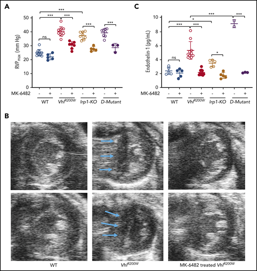 MK-6482 treatment reduced pulmonary hypertension in VhlR200W, Irp1-KO, and double-mutant VhlR200W;Irp1-KO mice and diminished elevated endothelin-1 levels in all 3 mouse models. (A) RVPs measured by catheterization of lightly anesthetized mice showed significantly elevated pressures in VhlR200W, Irp1-KO, and VhlR200W;Irp1-KO mice in comparison with WT mice, and MK-6482 treatment significantly decreased the RVPs, not only in VhlR200W and Irp1-KO mice, but also in double-mutant VhlR200W;Irp1-KO mice. (B) Transthoracic echocardiography showed systolic flattening of the IVS in vehicle-treated VhlR200W mice, as indicated by the appearance of an abnormal D-like structure (arrows) compared with the normal convex appearance of the IVS in the WT mice. The D-like structure disappeared and the normal convex shape of the IVS reappeared upon treatment with MK-6482. Representative images from 2 animals of each group are shown. Five mice from each group were tested, except for the drug-treated VhlR200W;Irp1-KO group, in which 3 mice were tested. (C) Serum endothelin-1 levels were elevated in VhlR200W, Irp1-KO, and VhlR200W;Irp1-KO mice compared with the WT mice. When treated with MK-6482, the endothelin-1 levels of the mutant and double-mutant mice reverted to normal WT levels. ns, not significant, *P < .05; ***P < .001 by ordinary 1-way ANOVA (multiple comparisons). D-mutant, double-mutant VhlR200W;Irp1-KO mouse.