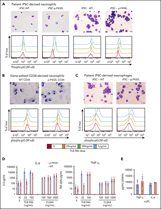Myeloid differentiated cells derived from patient iPSCs and gene-edited CD34s with the TLR8 variants demonstrated increased responsiveness to TLR8 stimulation. (A) Cytospin analysis of cells derived from neutrophil differentiation of WT or p.P432L iPSC clones from patient (P2) and WT or p.F494L iPSC clones from patient (P3) and their upregulation of phosphorylated p65 (NF-κB) in response to stimulation with the indicated doses of the TLR8-ligand TL8-506. (B) H&E stain of cytospin from cells derived from neutrophil differentiation of WT and gene-edited (p.P432L) healthy donor human CD34+ HPCs and their upregulation of phosphorylated p65 (NF-κB) in response to the TL8-506. Cells in flow plots are gated on CD45+CD66b+ neutrophils. Data are representative of 2 independent experiments. (C) Cytospin analysis of cells derived from macrophage differentiation of WT or p.P432L induced pluripotent stem cell (iPSC) clones from patient (P2) and phosphorylated p65 (NF-κB) in response to stimulation with the indicated doses of the TLR8-ligand TL8-506. Cells are gated on CD45+CD14+ macrophages. (D-E) iPSC-derived macrophages with WT or p.P432L TLR8 from patient (P2) were cultured overnight with the indicated doses of TL8-506 (TLR8 agonist), CL264 (TLR7 agonist), or LPS (TLR4 agonist). (D) Cytokines were measured in the cell culture supernatant and demonstrate that macrophages with variant TLR8 produced significantly more IL-6 and TNF-α with low-dose TLR8 stimulation (TL8-506, 25ng/mL) compared with cells with WT TLR8. There was no difference in the cytokine response to TLR7 stimulation (CL264), and doses of CL264 <100 ng/mL did not result in cellular activation (data not shown). (E) WT and p.P432L macrophages had a similar response to the TLR4 ligand LPS with respect to production of TNF-α and IL-6. NS, no stimulation. Data are presented as mean ± SEM and includes data from 3 independent experiments, analyzed by 2-way ANOVA. Findings that are statistically significant are denoted by an asterisk (*P ≤ .05).