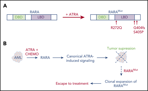 Sequential dual effects of ATRA therapy in patients with AML. (A) Selection of RARA mutations conferring ATRA resistance in ATRA-treated pediatric AML,102 fs, frameshift. (B) Proposed mechanism for ATRA activity and mutant selection in ATRA-treated AML. Treatment-selected dominant-negative RARA mutants (RARAMut) enhance self-renewal and block differentiation, contributing to AML relapses. CHEMO, anthracycline-based chemotherapy; LBD, ligand-binding domain; DBD, DNA-binding domain.