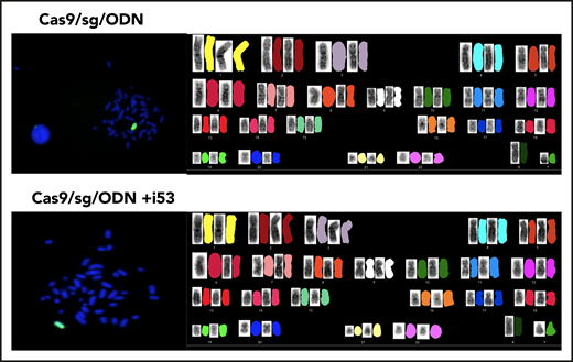 FISH (left) and karyotyping (right) studies in GE HSPCs. HSPCs CD34+ were genome edited without i53 (top) (n = 10 cells) and with i53 (bottom) (n = 15 cells).