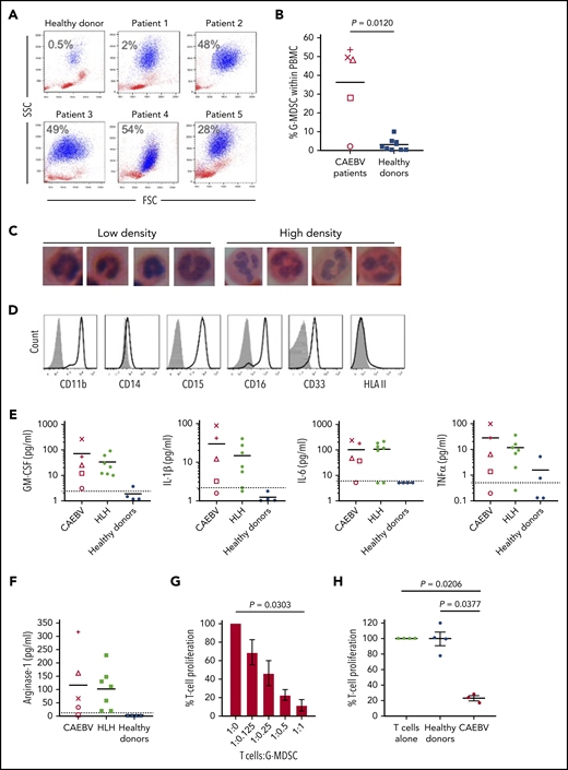 Granulocytic MDSCs are expanded in the blood of patients and potently inhibit T-cell responses. (A) Flow cytometric analysis of fresh patient PBMC by FSC vs SSC showed the presence of large granular cells (G-MDSCs), shown in blue; percentage of G-MDSCs to total PBMCs isolated is shown. A representative healthy donor is shown for comparison. (B) The percentage of G-MDSC is plotted with the mean compared with the mean from 10 healthy donors. A 2-tailed Mann-Whitney test was used to compare groups. (C) Nuclear morphology of G-MDSCs (low density) and neutrophils (high density) revealed characteristic band cell/neutrophil morphology by hematoxylin and eosin staining at ×100 magnification. (D) Flow cytometric analysis of the G-MDSC revealed expression of CD11b, CD15, CD16, CD33 but no expression of HLA II. Isotype controls (gray-filled histogram) are shown. (E) Luminex assays for GM-CSF, IL-1β, IL-6, and TNF-α were performed upon patient plasma and compared with healthy donors. All patients had higher concentrations of these cytokines in their plasma than the healthy donors. Dashed horizontal line indicates the limit of accurate detection. (F) Luminex assay was used to determine the concentration of arginase-1 in the plasma of CAEBV and EBV-HLH patients, and healthy donors. Dashed horizontal line indicates the limit of accurate detection. (G) Inhibition of T-cell proliferation by MDSCs was measured following coculture of T cells with decreasing numbers of G-MDSCs (T:G-MDSC range 1:1 to 1:0.125). The percentage T-cell proliferation in the presence of G-MDSCs is plotted relative to T cells alone. Data shown are an average of 3 patients. (H) The inhibition of T-cell proliferation by G-MDSCs from patients and healthy donors at a T-cell:G-MDSC ratio of 1:1 is plotted. Proliferation is shown relative to control (T cells stimulated in the absence of MDSCs). In panels G-H, a Kruskal-Wallis test was used to compare groups. In panels B, E, and F, each patient is represented by a unique symbol as follows: patient 1 = +, patient 2 = ×, patient 3 = ○, patient 4 = △, and patient 5 = □.
