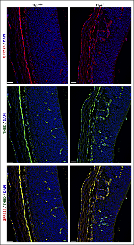 Gpr124 was present in glomeruloid bodies of E13.5 Tfpi−/−brain. Forebrain sections from Tfpi+/+ and Tfpi−/− littermates were stained for the extracellular domain of Gpr124 (red) and thrombomodulin (green), with DAPI-stained nuclei (blue) to depict the PNVP of the anterior forebrain and the adjacent lateral ventricle. Gpr124 stains well-organized vasculature in the Tfpi+/+ brain and the disorganized vasculature penetrating from the PNVP into the brain parenchyma in the Tfpi−/− brain. In the overlay, thrombomodulin stains the endothelial cells in the same pattern as Gpr124 in both embryos. Autofluorescence of the embryonic nucleated RBCs is observed within the vasculature of both embryos and areas of hemorrhage in the Tfpi−/− embryo (scale bars, 30 µm).