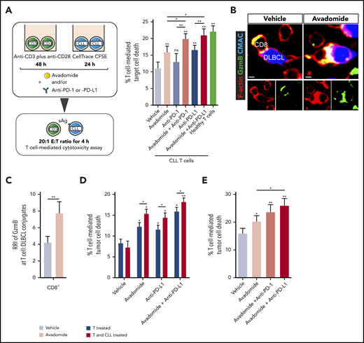 Pairing anti-PD-L1/PD-1 with avadomide effectively reactivates anti-CLL T cell killing function. (A) Illustration of the autologous cytotoxicity assay using treated patient T cells mixed with treated CLL cells and flow-based quantification of T-cell killing function against superantigen (sAg)-pulsed CLL cells as target cells (mean % CLL cell death ± SEM for n = 10 patients) following the treatments indicated. Aged-matched healthy donor T cell effector activity against autologous B cells loaded with sAg (as target cells) was included as a control. (B) Representative confocal images showing CD8+ tumor-infiltrated lymphocytes (TILs) forming granzyme B+ (Gzmb, green), F-actin (red) lytic synapses with primary autologous DLBCL tumor cells (blue) with avadomide treatment (nontumoricidal dose) (colocalization signal: yellow) (original magnification ×63, scale bars: 5 μm). (C) Relative recruitment index, RRI image analysis of Granzyme B (green) polarization in autologous CD8+ TIL:DLBCL conjugates following vehicle or avadomide treatment (n = 5). (D) Autologous T-cell killing function against patient CLL cells (n = 10) following treatment of patient T cells alone (before mixing with untreated CLL cells) or treating both T cells and CLL cells. (E) T-cell-mediated cytotoxicity against baseline autologous CLL cells using 12 CLL patient samples who had received ibrutinib-based therapy for 12 months. T cells and tumor cells were treated as indicated. *P < .05; **P < .01; ns, not significant using a repeated measures 1-way ANOVA with Tukey's multiple comparisons test (A and E) (or an unpaired t test for comparing CLL T-cell activity with healthy donor T cells), Wilcoxon signed-rank test (C) and 2-way ANOVA (D). Data presented as mean ± SEM.
