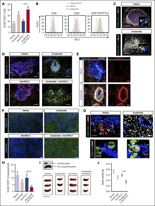 Therapeutic avadomide converts CD8+ T cell excluded (noninflamed) patient-derived xenografts into CD8+ T cell-inflamed tumors that respond to anti-PD-L1 combination therapy. (A) Flow cytometric percentage of patient CD8+ CD25+ T cells harvested from CLL patient-derived xenograft splenic TMEs following drug treatments (n = 6 patient samples, 3-4 mice per patient sample treatment group). (B) Representative flow cytometric histograms of PD-L1 expression on patient CD4+, CD8+ T cells, and CD5+ CD19+ CLL cells harvested from the splenic TME comparing vehicle (blue) and avadomide (red) treated mice. Representative multispectral immunofluorescence images of splenic TME tissue (n = 6 patient samples) from treated mice (C) for human CD20 (blue), CD8+ (green), CD4+ (red) patient T cells and PD-L1 (white); (D) for human CD20 (blue), CD8+ (green) and CD4+ (red) patient T cells; (E) for human CD20 (blue), CD8+ (green), CXCL10 (red), and CXCR3 (white); (G) for human CD20 (blue), CD8+ (green), CD4+ (red) patient T cells, and granzyme B (GZMB) (white). Original magnification, ×20 medial optical section images (scale bar = 100 μm for panels C-E and 20 μm for panel G) and 3D volume rendered confocal images of intercellular PD-L1+ (C) or GZMB+ (G) CD8+ T cell interactions (white/green) with CLL cells (blue) with treatments (cropped, ×20 images). (F) Representative large images acquired by an Olympus BX61VS fluorescence slide scanner (original magnification, ×4, scale bar = 200 μm) of splenic TME tissue (n = 6 patient samples) from treated mice for human CD20 (blue) and CD8+ (green) patient T cells. (H) CLL tumor burden in splenic TMEs. Flow cytometric percentage of human CD5+ CD19+ CLL cells of tissue splenocytes (total nucleated cells, human and murine) (n = 6 patient samples, 3-4 mice per patient sample treatment group) analyzed from splenic TMEs following drug treatments. (I) Representative pictures of patient-derived xenograft splenic TME tissues. An established tumor (CLL PBMC engrafted spleen) in comparison with a nondiseased healthy murine spleen is shown (top). Xenograft splenic TME tissues are shown following different treatments (scale bar = 2 cm). (J) Weight of xenograft (n = 3 patient samples) spleen TME tissues following drug treatments. *P < .05; **P < .01; ns, not significant using a repeated measures 1-way ANOVA with Tukey's multiple comparisons test (A,H,J). Data presented as mean ± SEM.
