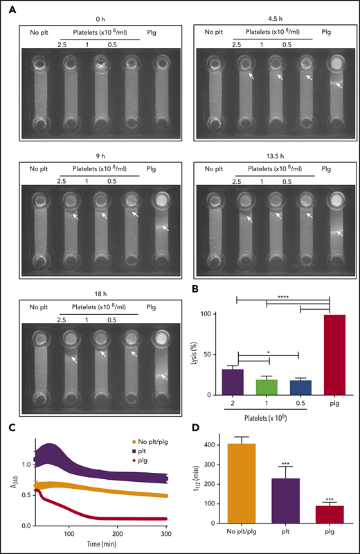 Platelets can drive fibrinolysis via a plasmin-mediated mechanism. (A-B) Purified clots were formed from plasminogen-free fibrinogen (2.4 μM) and DL488 plasminogen-free fibrinogen (0.25 μM) in the presence or absence of glu-plasminogen (0.24 μM) and in the presence or absence of the indicated concentration of platelets. Clotting was initiated by thrombin (0.25 U/mL) and CaCl2 (5 mM), and clots were allowed to form for 30 minutes before addition of 75 nM tPA to the edge of the clots. Lysis was monitored by imaging every 15 minutes for 18 hours. (B) The distance lysed at 18 hours as a percentage of the plasminogen control (set to 100%). *P < .05 and **** P < .0001 compared with plasminogen control clots. (C-D) Purified clots were formed as above with or without 2.5 × 108 platelets/mL in the absence of DL488 fibrinogen. Turbidity was monitored every minute at 340 nm for 30 minutes at 37°C in a FLX-800 plate reader (Biotek Instruments). After 30-minute polymerization, 1 nM tPA (Genentech) was overlaid onto each clot, and turbidity was subsequently monitored every minute for 5 hours. (D) Fifty percent lysis times. ***P < .01 compared with no plasminogen control clots. Data are expressed as mean ± SEM, n ≥ 3.