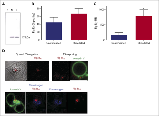 Platelets express the transmembrane Plg-RKT. (A) Fractions of platelets (1 × 107), lysate (L), soluble (S), and membrane (M) were run on 4% to 12% NuPAGE gels followed by western blotting with anti–Plg-RKT mAb (7H1) fractions. Representative image of n = 4. (B-C) Platelets (2 × 108 platelets/mL) were either unstimulated or stimulated with CVX (100 ng/mL) plus thrombin (100 nM) in the presence of anti–Plg-RKT mAb-DL550. Data are presented as mean ± SEM for (B) percentage platelets positive for Plg-RKT and (C) MFI. *P < .05 vs unstimulated, n = 3. (D) Platelets (0.5 × 108 platelets/mL) stimulated on a collagen (0.6 µg) and thrombin (3 pmol) coated surface for 45 minutes were stained with Annexin V-AF488, anti-plasminogen mAb-DL633, and anti-Plg-RKT mAb-DL550. Scale bars, 5 μm; representative images of n = 4.