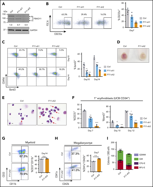 FBXO11 regulates human erythropoiesis. Peripheral blood–mobilized human CD34+ cells (A-E,G-I) were expanded for 2 days and then transduced with lentiviral vectors encoding green fluorescent protein (GFP) and FBXO11 (F11-sh) or control (Ctrl) shRNAs. At day 4, FACS-purified GFP+ cells were cultured under conditions supporting erythroid (A-F), myeloid (G), megakaryocyte (H), or multilineage (I) differentiation. (A) Western blot showing FBXO11 protein expression at culture day 10. The asterisk denotes a nonspecific band. The number below shows quantification of the major isoform of FBXO11 (i4) normalized to GAPDH protein for each condition. (B) Flow cytometry plots showing the expression of the erythroid marker CD235a at culture day 7. The graph shows the mean ± SEM from 4 biological replicate experiments. (C) Flow cytometry plots showing the expression of Band3 and CD49d at culture days 10 and 14. The graph shows the mean ± SEM from 4 biological replicate experiments. (D) Cell pellets at day 10. (E) May-Grünwald-Giemsa–stained erythroblasts at day 14. Red arrows denote immature erythroblasts. Scale bar, 10 μM. (F) Umbilical cord blood (UCB) CD34+ cells expressing FBXO11 (F11-sh) or Ctrl shRNAs were cultured in erythroid cytokines. Graphs show the fraction of cells expressing CD235a or Band3 (mean ± SEM) at the indicated time points in 3 biological replicate experiments. (G) Peripheral blood CD34+ cells expressing FBXO11 (F11-sh) or Ctrl shRNAs were cultured with myeloid cytokines. Flow cytometry plots show the expression of CD11b and CD33 at culture day 14. The graph shows the mean ± SEM from 3 biological replicate experiments. (H) Peripheral blood CD34+ cells expressing FBXO11 (F11-sh) or Ctrl shRNAs were cultured with megakaryocytic cytokines. Flow cytometry plots show the expression of CD41a and CD42b at day 7. The graph shows the mean ± SEM from 3 biological replicate experiments. (I) A total of 300 peripheral blood CD34+ cells expressing Ctrl or F11-sh2 shRNA were suspended in 1 mL of methylcellulose containing multilineage cytokines. Hematopoietic colonies were enumerated after 14 days. The graph shows the mean ± SEM from 3 replicate experiments. BFU-E, burst-forming unit-erythroid; CFE-E, colony-forming unit-erythroid; GEMM, granulocyte, erythroid, macrophage, megakaryocyte; GM, granulocyte macrophage. *P < .05; **P < .01; ***P < .001; ****P < .0001 relative to shRNA luciferase (shLuc) (unpaired Student t test).