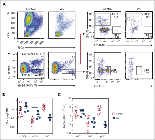 WHIM patients harbor quantitative defects in pDCs. (A) Blood DC subsets were analyzed in WHIM patients and healthy donors. Representative pseudo-color dot plots obtained for the same volume of blood from 1 healthy control (control) and 1 WHIM patient (WS) carrying the heterozygous CXCR4+/1013 mutation are shown. cDC2 was defined as CD11c+HLA-DR+CD1c+ cells, cDC1 as CD11c+HLA-DR+CD141+ cells, and pDCs as CD11c−HLA-DR+CD303+ cells. Percentages among parent cells are indicated. (B-C) The frequency of DC subsets among peripheral blood mononuclear cells (B) and their concentrations (C) were measured for healthy controls (control) and WHIM patients (WS). Each point represents an individual and lines indicate the mean ± standard error of the mean (SEM). n = 9 Controls and n = 4 WS (B); n = 7 controls and n = 4 WS (C). Statistical analysis was performed using the 2-tailed, unpaired Mann-Whitney test. *P < .05, **P < .01.