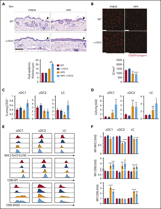 CXCR4 dysfunction promotes HPV-associated chronic inflammation while preserving DC subset activation. (A) Representative images for hematoxylin and eosin coloration of flank skin sections (upper). Epidermal (arrowheads) thickness was measured along the tissue, with at least 10 measurements per sample (lower, mean ± SEM, n = 6-8 mice). Scale bar, 100 µm. (B) Representative confocal microscopy images (top) from epidermal sheets stained for CD207 (red). CD207+ cells were counted in 5 fields per sample (n = 3 samples per genotype) and the cell density calculated (bottom). Scale bars, 25 µm. (C) Percentage of cDC1, cDC2, and LCs among CD45+ skin cells. (D) Number of cDC1, cDC2, and LC per milligram of skin as the fold change relative to WT (see supplemental Figure 5 for the gating strategy, mean ± SEM, n = 9-11 per group, cumulative data from 4 independent experiments). (E) Representative histograms showing the surface expression of MHC2, CD80, and CD86 by cDC1, cDC2, and LCs from WT, +/1013, HPV, and HPV+/1013 mice. (F) Bar graphs show the expression of MHC2, CD80, and CD86 as the fold change relative to WT (mean ± SEM, n = 10-12 mice/group for MHC2 from 5 experiments, n = 9-11 mice/group for CD86 from 4 experiments, n = 7-9 mice/group for CD80 from 3 experiments). Mice had an FVB/N genetic background. Statistical analysis was performed using the 2-tailed, unpaired Mann-Whitney test to compare HPV mice and HPV+/1013 genotypes (A, **P < .01) or HPV and HPV+/1013 mice to their non-HPV counterparts (B-E, *P < .05, **P < .01, ***P < .005, ****P < .001).