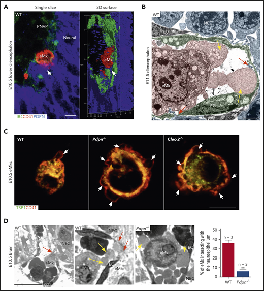 eMks interact with PDPN-expressing neuroepithelium. (A) Confocal microscopic image of single optical slice (left) and a 3-dimensoinal surface rendering (right) of an eMk within the lower diencephalon PNVP closely associated with PDPN+ neural tissue (arrows). (B) Pseudocolored TEM image of an eMk with lamellipodia (yellow arrows) and neuroepithelium (red arrows point to interaction with eMk) in an angiogenic sprout (green) in the lower diencephalon. NEC, neuroepithelial cell. EC, endothelial cell. (C) Confocal microcopy of eMks stained with the α-granule marker TSP-1 in the lower diencephalon. CD41 marks the eMks; arrows mark CD41+TSP-1− ectoplasmic lamellipodia. (D) Representative bright-field microscopy of semithin sections of eMks and their lamellipodia (yellow arrows) in the PNVP (left image) and vascular sprouts in the neural tissue (right 2 images) of the diencephalon. Red arrows mark interactions of lamellipodia processes with neuroepithelium (NEC). The percentage of eMks interacting with NECs in the diencephalon is shown on the right. Data represent mean ± standard error of the mean; n, embryos with at least 20 eMks/embryos analyzed. Scale bars, 10 μm (A,C-D); and 2 μm (B). **P < .01.