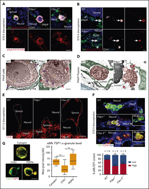 Heightened activation of eMks and platelets in Pdpn−/− and Clec-2−/− vasculature during midgestation. (A-B) Confocal images of diencephalon sections with an antibody to phospho-Syk (Y519/520) (A) or an antibody to phospho-PLCγ2 (Y1217; arrows) (B). 4′,6-Diamidino-2-phenylindole is the nuclear stain. (C-D) Pseudocolored TEM of eMks (C) or platelets (D) in the PNVP vessel lumen of the lower diencephalon. eMk demarcation membrane system (asterisks), microparticles (red arrows), and lamellipodia (pink arrows) are indicated (C). Platelet filopodia projections (orange arrow) and granule secretion (red arrow) are indicated (D). (E) Confocal images of diencephalon sprouts and COL-1 expression. Dashed lines outline each sprout. (F) Confocal images of eMks with α-granules labeled with TSP-1 in the lower diencephalon. Insets show eMks in the midbrain. Bar graph (bottom) represents the percentage of fetal Mks with high or low TSP-1 threshold levels. (G) Confocal images of eMks isolated from E11.5 peripheral blood, that were either plated on a slide through cytospin as a negative activation control or incubated on a slide coated with COL-1 or PDPN for 30 minutes. The α-granules were labeled with TSP-1. The bar graph (right) represents eMk α-granule intensity. Data represent mean ± standard error of the mean and 3 experimental repeats with at least 3 technical repeats each. Scale bars, 10 μm (A-B); 2 μm (C); 500 nm (D); 20 μm (E-F); and 5 μm (G). **P < .01.