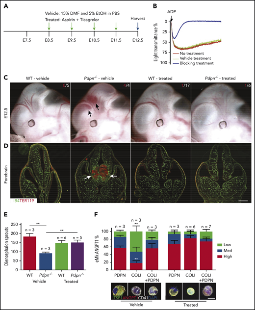 Blocking platelet activation mitigates Pdpn−/− vascular defects. (A) Overview of strategy to block platelet activation: the pregnant dam was treated once daily (green arrows) by oral gavage, and embryos were harvested at E12.5 (blue arrow). (B) Platelet aggregation analysis from treated pregnant dams before embryo harvest. (C) Gross images of embryo heads, showing hemorrhages (arrows). Numbers represent embryos with bleeding (red)/total embryos (white). (D) Confocal images of forebrain vasculature and bleed areas (arrows). IB4, vessel; TER119, red cells. (E) Bar graph represents quantification of all diencephalon vascular sprouts from PNVP; n, number of embryos. (F) Bar graphs represent percentage of eMks with high, medium, or low ANGPT-1 threshold levels after a 30-minute treatment with either vehicle or 30 μmol aspirin + 10 μmol ticagrelor and then a 30-minute static adhesion on plates containing PDPN, COL-1, or both. Below are corresponding confocal images of representative eMks. Data represent means ± standard error of the mean; n, number of experimental repeats, with 3 technical repeats each. Scale bars, 500 μm (D) and 10 μm (F). **P < .01.