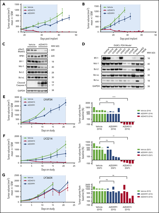 Bfl-1 is a positive response biomarker for CDK9 inhibitor antitumor efficacy across DLBCL cell line and PDX tumors in vivo. (A-B) CB17 SCID mice were implanted with OCILY10 (A) or TMD8 (B) cells and xenograft tumors grew to ∼200 mm3 prior to treatment with AZD4573 or AZD5991. (C) Pharmacodynamic analysis of pSer2-RNAP2, cleaved caspase-3, and antiapoptotic Bcl-2 family proteins in OCILY10 xenograft tumors after 4 hours of AZD4573 treatment. Western blot loading control, GAPDH. (D) Western blot analysis of prosurvival Bcl-2 family protein levels across 8 DLBCL PDX tumor models. Loading control, GAPDH. (E-G) NOD SCID mice were implanted with LY6934 (E), LY2214 (F), or LY3604 (G) DLBCL patient-derived tumor cells and treated with either AZD4573 or AZD5991 for 3 dosing cycles. Left panels, antitumor drug responses throughout the entire study duration. Right panels, individual animal tumor volumes at the indicated day. **P < .01; ****P < .0001. ns, no significance.