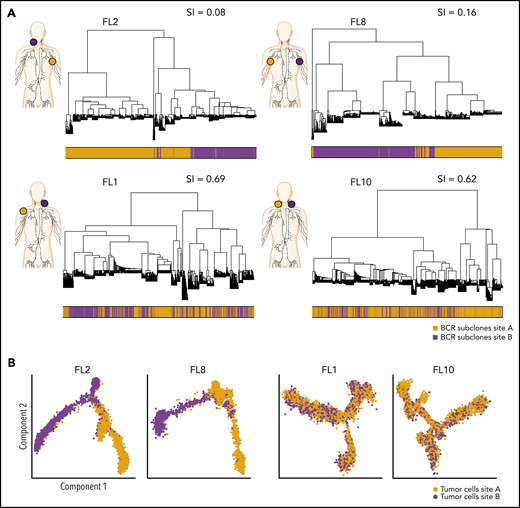 Phylogenetic analysis of BCR-defined subclones reveals site-specific patterns. (A) Representative phylogenetic trees based on immunoglobulin heavy chain VDJ sequences from single-cell BCR sequencing of tumor samples from both sites from 2 patients with site-specific BCR subclones (FL2, FL8) and from 2 patients with shared BCR subclones (FL1, FL10). The sampled malignant lymph node sites (site A in orange, site B in purple) are visualized on the left for each patient. The bar below the phylogenetic tree reveals the site of origin for each BCR sequence in the tree. Similarity index (SI) according to Renkonen is given on the top right for each patient. (B) Representative trajectory analysis of tumor cells from scRNA-seq of tumor samples from both sites (site A and site B) from 2 patients with site-specific BCR subclones (FL2, FL8) and from 2 patients with shared BCR subclones (FL1, FL10). The cells are colored by tumor site.