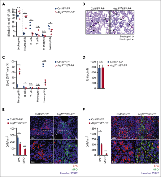 Knocking out Atg5 in the eosinophil lineage results in reduced severity of FIP1L1-PDGFRα–mediated experimental eosinophilic leukemia. (A) Cell counts. Total leukocyte counts were measured in the peripheral blood of CtrlII5tg-F/P and Atg5eoΔII5tg-F/P recipient mice using the scil Vet abc Plus+ hematology analyzer (scil animal care company GmbH, Viernheim, Germany) on day 33 after transplantation. Relative numbers of neutrophils (CD45+/CD11b+/Ly6G+), B cells (CD45+/B220+), T cells (CD45+/CD3+), monocytes (CD45+/CD11b+/CD115+), and eosinophils (CD45+/CD11b+/Siglec-F+) were determined by flow cytometry, and an absolute count for each cell population was calculated (n = 3-4). (B) Light microscopy. Peripheral blood smears of CtrlII5tg-F/P and Atg5eoΔII5tg-F/P recipient mice on day 33 after transplantation were stained with the Hemacolor Rapid Staining Kit (MilliporeSigma, Burlington, MA), followed by light microscopy analysis. Scale bars, 10 µm. (C) Flow cytometry. Relative numbers of cell populations transduced with the F/P fusion gene were determined by EGFP coexpression in the peripheral blood of CtrlII5tg-F/P and Atg5eoΔII5tg-F/P recipient mice 33 days after transplantation (n = 3-4). (D) Enzyme-linked immunosorbent assay measurements. IL-5 concentrations were measured in the plasma of CtrlII5tg-F/P and Atg5eoΔII5tg-F/P recipient mice on day 33 after transplantation (n = 3-4). Confocal microscopy. Formalin-fixed, paraffin-embedded liver (E) and colon (F) tissue sections of CtrlII5tg-F/P and Atg5eoΔII5tg-F/P recipient mice were stained with monoclonal mouse anti-EPX (red) and polyclonal goat anti-myeloperoxidase (MPO) (green) antibodies. Hoechst 33342 (blue) was used for nuclear DNA visualization. Quantification of EPX+ and MPO+ cells was performed by counting cells manually in 10 randomly selected high-power fields, each covering the area of 22.5 × 10−3 mm2 using an automatic digital slide scanner (Pannoramic MIDI II, 3DHistech, Budapest, Hungary) (n = 3). Right: representative confocal microscopy images are shown. Scale bars, 10 µm. Values are means ± standard error of the mean, or single data are presented in scatter dot plots in which the medians are indicated as red lines. *P < .05; **P < .01; ***P < .001. n.s., not significant.