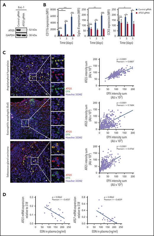 ATG5 is required for the differentiation of human eosinophilic leukemic cells, and ATG5low-expressing human eosinophils are more susceptible to degranulation. (A) Immunoblotting. EoL-1 cells were transduced with lentiviral constructs containing Cas9 and guide RNA (gRNA) targeting ATG5. Whole-cell lysates of control and ATG5-knockout EoL-1 cells were collected and analyzed for the presence of ATG5 protein expression. Glyceraldehyde-3-phosphate dehydrogenase (GAPDH) served as loading control. Representative immunoblots of 2 independent experiments are shown. (B) Flow cytometry. Differentiation of control and ATG5-knockout EoL-1 cells was induced by the addition of 0.5 mM butyric acid, and the surface expression of eosinophil markers CD11b, Siglec-8, and CCR3 was assessed (n = 3). (C) Confocal microscopy. Formalin-fixed, paraffin-embedded human tissue sections of angiolymphoid hyperplasia (upper image), EoE (middle image), and sebaceous gland carcinoma (lower image) were stained with monoclonal mouse anti-EPX (green) and monoclonal rabbit anti-ATG5 (red) antibodies. Hoechst 33342 (blue) was used for nuclear DNA visualization. Representative confocal microscopy images are shown. Scale bars, 10 µm. Right: correlation analysis between the fluorescent intensity sums of EPX and ATG5, measured in all eosinophils, was performed for each tissue section, and the Pearson coefficient calculated in each case. (D) Correlation analysis between eosinophil-derived neurotoxin (EDN) levels in plasma and mRNA expression of ATG5 or ATG7 in blood eosinophils isolated from patients with hypereosinophilic syndrome (n = 19). Values are means ± standard error of the mean, or single data are presented in scatter dot plots in which the linear regression is indicated as blue lines. *P < .05; **P < .01; ***P < .001. AU, arbitrary unit; MFI, mean fluorescent intensity; n.s., not significant.