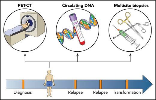 Capturing spatial and dynamic heterogeneity in follicular lymphoma. Sampling of multiple nodal and extrandodal sites, to provide tissue for genomic, transcriptomic, proteomic, and functional assays on the malignant B-cell environment and TME, combined with PET-CT scans and circulating DNA, will provide a comprehensive biological profile. Sequential assays, performed at diagnosis and all subsequent clinical inflection time points, enable the temporal dynamics of site-to-site heterogeneity to be captured. Professional illustration by Patrick Lane, ScEYEnce Studios.