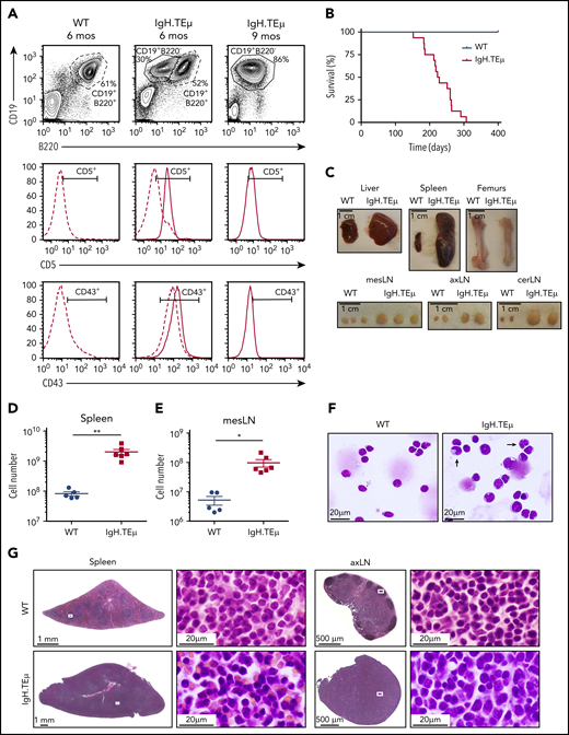 IgH.TEμ CLL mouse model recapitulates key features of the human pathology. Aging mouse cohorts of IgH.TEμ transgenic mice and wild-type (WT) littermate control animals were monitored over time for disease development and progression and analyzed at end-stage. (A) Representative flow cytometric profiles of splenocytes stained for CD19, B220, CD5, and CD43 of WT littermate control and IgH.TEμ mice at indicated time points, 6 and 9 months (mos), are shown. The CD5 and CD43 histograms are gated on CD19+ B220+ B cells for WT control (dashed line, left) and on CD19+ B220+ (dashed line) and CD19+ B220− (solid line, center and right panels) for IgH.TEμ mice. (B) Kaplan-Meier survival curves of WT (blue line, n = 10) and IgH.TEμ (red line, n = 16) aging cohorts. (C) Macroscopic view of representative tissues: 1 liver lobe, spleen, femurs, and lymph nodes (LN) derived from WT and IgH.TEμ mice at end-stage (9 months LN; 10 months spleen, liver, and femur) is depicted. Absolute cell numbers of CD19+ cells (D) in the spleen and (E) mesenteric LN (mesLN) of WT littermates (blue circles, n = 5) and IgH.TEμ mice (red squares, n = 6) are displayed. P values were calculated using unpaired Student t test: **P = .0026, *P = .0150. (F) May Grunwald-Giemsa staining of cytospin preparations of splenocytes from WT littermate control (left) and IgH.TEμ mice (right) at 7 months. Arrows point to the larger and more folded nuclei of B lymphocytes in splenocytes of IgH.TEμ mice. (G) Hematoxylin and eosin staining of spleen and axillary LN (axLN) sections from WT littermate control (upper) and IgH.TEμ mice (lower) at 7 months. Scale bars as indicated.