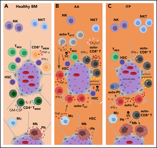 Pathophysiology of mature BM lymphocytes in autoimmune cytopenias. (A) In healthy BM, mature lymphocyte populations regulate HSC self-renewal, maintenance and hematopoietic output by producing soluble factors and likely by (as yet undefined) direct cell-cell interactions. (B-C) In AA and ITP, this delicate regulatory balance is distorted. For example, chronic exposure to high levels of inflammatory cytokines results in HSC loss, as seen in AA, and megakaryocyte (Mk) malfunction, as seen in ITP. (B) In AA, the patients’ BM is infiltrated by activated autoreactive (auto-)CD8+ T cells that express high levels of CX3CR1 and are recruited by CX3CL1 present in AA BM. BM auto-CD8+ T cells secrete high amounts of TNF-α and IFN-γ, and also use perforin- and granzyme-mediated mechanisms to directly target HSCs. Polyclonal BM auto-CD4+ T-cell numbers are increased in AA, and Th17-cell expansion is characteristic. Elevated levels of IL-17 impair hematopoiesis by depleting Tregs, directly inhibiting HSCs, and recruiting additional Th1 cells. IL-17 also promotes the secretion of TNF-α by macrophages (Mϕs), which in turn stimulates IFN-γ secretion by T cells. Patients with AA have reduced NK- and NKT-cell numbers in their BM. Whereas the significance of this finding for NKT cells is unclear, the reduction of BM NK cells in patients with AA may contribute to the excess of auto-CD8+ T cells as result of decreased T-cell killing by NK cells. (C) In patients with ITP, low platelet (plt) numbers are the predominant clinical feature. Presumably, BM auto-CD8+ T cells recognize megakaryocyte-derived antigens presented on platelets via MHC-I and can lyse platelets directly or induce platelet apoptosis. Moreover, suppression of megakaryocyte apoptosis by BM auto-CD8+ T cells directly inhibits platelet formation. BM auto-CD4+ T cells induce the production of anti-platelet autoantibodies (anti-plt abs) involved in disease pathogenesis. Patients with ITP have lower total numbers of CD4+ T cells in the BM than healthy controls. The disproportional loss of BM Th2 cells, as well as Tregs, results in a Th1 shift that contributes to autoantibody-mediated platelet destruction and T-cell cytotoxicity. The localizations and functions of BM NK and NKT cells in ITP are largely unknown.