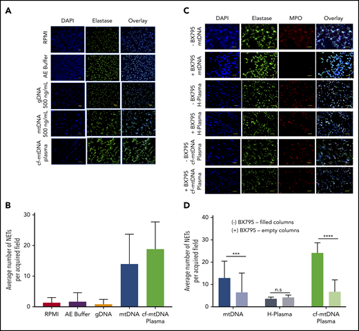 Induction of NET formation by gDNA and mtDNA and SCD plasma, with and without BX795. (A) Fluorescence microscopy images from a representative experiment showing NET formation following 7 hours of treatment with a similar concentration of gDNA purified from whole blood or mtDNA purified from platelets or 10% plasma with high cf-mtDNA from a patient with SCD. As a control, neutrophils were left untreated in RPMI 1640 or in RPMI 1640 containing AE Buffer (the buffer in which gDNA and mtDNA were eluted following purification with a QIAGEN kit). Original magnification ×20. (B) NET production (average number of NETs ± SD) induced with AE Buffer (n = 2; 1.67 ± 2.92), gDNA (n = 2; 0.80 ± 1.60), purified mtDNA (n = 5; 14.00 ± 9.70), or cf-mtDNA SCD plasma (n = 5; 18.90 ± 8.80). Representative fluorescence microscopy images (C; original magnification ×20) and NET counts (D) showing that a 4-hour pretreatment with 10 mM BX-795 decreased NET production after a 5 hour-induction with 500 mM purified mtDNA (n = 3; ***P = .0004) or cf-mtDNA in SCD plasma (n = 5; ****P = .0001), but it did not affect the basal NETosis with healthy plasma (H-Plasma; n = 3; P = .1170). n.s., not significant.