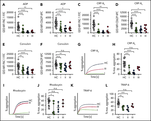 Sepsis platelets are hyporeactive. Platelet reactivity assays are shown at the following time points: I: admission day; II: day 5 to 7; and III: day of ICU discharge. (A-F) Platelet integrin activation (A,C,E) and P-selectin exposure (B,D,F) were measured upon stimulation with ADP (5 µM) (A-B), CRP-XL (0.01 µg/mL) (C-D), or convulxin (0.01 µg/mL) (E-F) in whole blood by flow cytometry. (G-L) Light transmission aggregometry was performed using washed platelets (500 000/µL). Maximum (max.) aggregation is depicted upon stimulation with CRP-XL (0.1 µg/mL) (G-H), rhodocytin (10 nM) (I-J), or TRAP-6 (10 µM) (K-L). Representative curves are shown in panels G, I, and K. CRP-XL samples were measured for 5 minutes, and rhodocytin or TRAP-6 samples for 10 minutes. Graphs show median ± IQR. Differences were analyzed by Kruskal-Wallis test (A-L). *P < .05; **P < .01; ***P < .001; ****P < .0001.