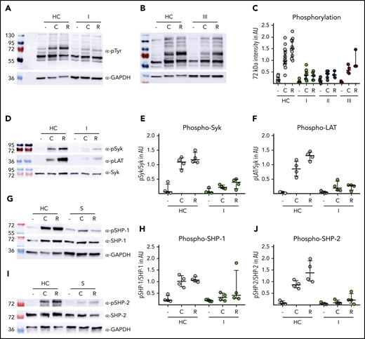 Sepsis platelets show impaired (hem)ITAM signaling. Washed platelets (500 000/µL) of healthy controls (HC) and patients with sepsis (S) were stimulated with CRP-XL (C) and rhodocytin (R). Lysis was done at the following time points: C: 5 minutes; R: 10 minutes. I: admission day; II: day 5 to 7; and III: day of ICU discharge. (A-C) Western blot analysis of platelet lysates. Staining was performed with anti-phospho-tyrosine antibody 4G10. Band intensity (72 kDa) was set in relation to signal intensity of Syk or GAPDH in AU. Representative blots are shown in panels A (time point I) and B (time point III). (D-F) Phosphorylation of signaling peptides Syk and Lat was investigated by immunoblot. One representative blot is shown in panel D. (G-J) Phosphorylation analysis of immunoreceptor tyrosine inhibitory motif signaling associated phosphatases SHP-1 and SHP-2. Phosphoprotein intensity was set in relation to intensity of unphosphorylated protein shown in panels H and J. Representative western blots are shown in panels G and I. All graphs display median ± IQR.
