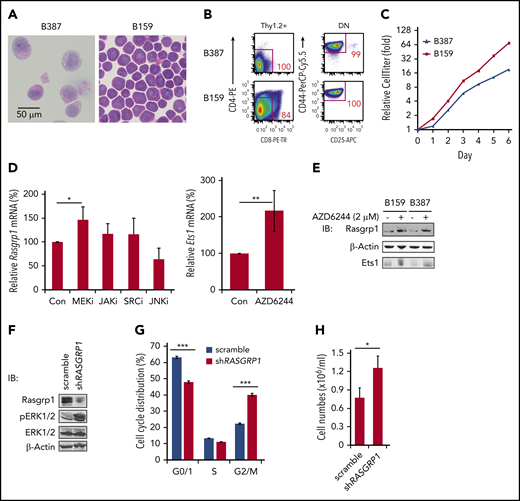 A feedback loop couples MEK/ERK hyperactivation and Rasgrp1 downregulation. (A-B) Representative hemoxylin and eosin-stained images (A) and flow cytometric plots of 2 cell lines (B387 and B159) (B) derived from Kras−/−; NrasQ61R/+ thymocytes. (C) Cell growth was measured using Cell TiterGlo assay. (D) B387 and B159 were treated with DMSO, 2 µM MEK inhibitor (AZD6244), 2 µM JAK inhibitor (CYT387), 100 nM SRC inhibitor (dasatinib), or 10 µM JNK inhibitor (SP600125) for 18 hours. Rasgrp1 and Ets1 mRNA levels were quantified using quantitative reverse transcription polymerase chain reaction. (E) Western blot analysis of Rasgrp1 and Ets1 protein levels in the absence or presence of AZD6244. (F-H) Jurkat cells, a human T-ALL cell line, stably expressed a scrambled shRNA or a RASGRP1 shRNA. (F) Western blot analysis of Rasgrp1, ERK1/2 and pERK1/2 protein levels. (G) Cell-cycle analysis. (H) Jurkat T cells were seeded at the same density and cell numbers were counted 48 hours later. P values were calculated with a 2-tailed Student t test. *P < .05; ***P < .001.
