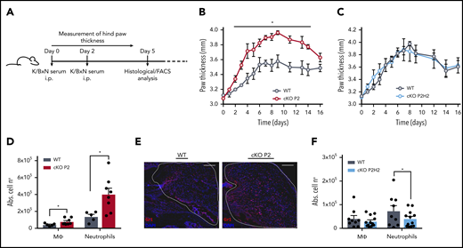 HIF-2α enhances neutrophil recruitment to the synovium in a mouse model of acute inflammatory arthritis. (A) Schematic representation of K/BxN serum-induced inflammatory arthritis. The inflammatory response was measured as paw thickness (mm) in cKO P2 mice (B) and in cKO P2H2 mice (C) vs their representative control littermates (n = 4). Data are representative of ≥6 (B) and 3 (C) individual experiments. Neutrophil recruitment was assessed via flow cytometry analysis, measured as absolute numbers (Abs. cell no) of neutrophils and macrophages in the synovial cavity in cKO P2 mice (n = 5-8) (D) and cKO P2H2 mice (F) vs WT littermates (n = 9-12). (E) Representative images of Gr1 immunofluorescence staining of the synovial cavity (dashed line) 5 days after the start of the experiment (scale bars, 50 μm). Data are represented as mean ± standard error of the mean. *P < .05, Mann-Whitney U test.