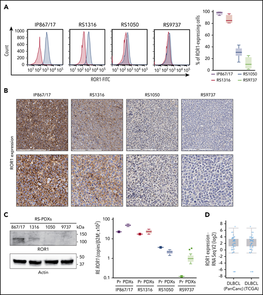 Expression of ROR1 in RS-PDX models and in DLBCL in TCGA data sets. (A) Representative histogram plots and a cumulative ROR1+ cells (%, n = 4) box plot, obtained by measuring ROR1 expression in RS cells after in vivo growth. Box plots show the distribution of values: median, interquartile range, minimum and maximum values. ROR1 expression was analyzed by flow cytometry using a specific anti-human ROR1 antibody in the 4 RS-PDX models available. RS-PDXs are represented with the indicated color coding. (B) IHC analysis of ROR1 expression in tissue sections of tumor masses obtained from the RS-PDXs using an anti-ROR1 antibody (mouse clone OTI3D11). Slides were developed with DAB (3,3'‑diaminobenzidine) and counter-stained with hematoxylin and eosin. Slides were scanned using an Aperio AT Turbo system to produce whole slide images. A .jpeg image of each stain is shown. Original magnification ×20 (top panel) and ×40 (bottom panel). (C) Western blots and qRT-PCR data showing the expression of ROR1. Actin was used as a loading control in western blot. qRT-PCR data (from primary RS samples and at least 4 different tumor masses) are reported as relative expression (RE) of the target gene over β2-microglobulin (B2M). Box plots show the distribution of values: median, interquartile range, minimum and maximum values (Tukey representation). Squares represent the primary samples. (D) Expression of ROR1 obtained from RNA-sequencing (RNA Seq) data in large data sets of DLBCL samples. Data are reported in The Cancer Genome Atlas (TCGA). Box plots show the distribution of values: median, interquartile range, minimum and maximum values. FITC, fluorescein isothiocyanate; PanCanc, pan cancer; Pr, primary samples.