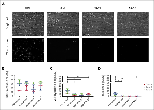 Effect of anti-GPVI Nbs in whole blood microfluidics. (A) Representative images of whole blood perfused at an arterial shear rate (1000/s) over Horm collagen I in the presence of either PBS or 500 nM Nb 2, 21, or 35. Adhered platelets and platelet aggregates were imaged in brightfield after 3.5 minutes of flow. Platelets were labeled with Annexin V AF568 to assess PS exposure. All images were taken on an EVOS AMF4300 using a 60×, 1.42 NA oil objective. Data are representative of 2 runs for each of 3 donors per treatment. Scale bars, 50 µm. (B-D) Quantitative analysis of the images assessed the effect of the Nbs on percentage of total surface area covered by platelets (B), multilayered thrombi (C), and platelets exposing PS (D). Data points are individual runs for each of 3 donors (shown in different colors) per treatment (mean ± SD). Unpaired Student t test with Mann-Whitney correction was used to test for statistical significance: **P < .005. SAC, surface area coverage.