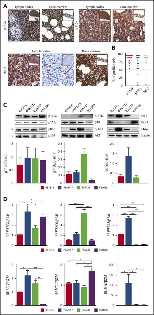 RS-PDX models molecular profiling. (A) Representative immunohistochemistry images of PI3K-δ/γ and Bcl-2 expression in lymph nodes and bone marrow biopsies of patients with RS (magnification ×40; insets ×4). (B) Percentage of PI3K-δ/γ and Bcl-2 positive cells in a cohort of 24 RS primary samples. Dashed line indicates the 50% threshold used to define positive samples. (C) Western blot panels showing expression of proteins belonging to the BCR and PI3K cascades (p110δ, p110γ, p85α, p101, p-BTK, BTK, p-AKT, AKT, c-Myc) and apoptotic pathway (Bcl-2, Mcl-1) in the available RS-PDX models (RS1316, IP867/17, RS9737, RS1050). Bar plots represent intensity of p110δ, p110γ, and Bcl-2 bands in 4 independent experiments. Band intensities were measured using Image Lab and normalized on β-actin. Data are reported as mean ± standard error of the mean (SEM). (D) Quantitative reverse transcriptase polymerase chain reaction analyses of members of the PI3K family (PIK3CD, PIK3CG, PIK3R5), apoptotic pathway (BCL2, MCL1), and MYC. Messenger RNA expression is normalized over β-2-microglobulin (B2M). Data are reported as mean ± SEM. RE, relative expression. Statistical analysis was performed using 1-way analysis of variance (ANOVA); *P < .05, **P < .01, ***P < .001, ****P < .0001.