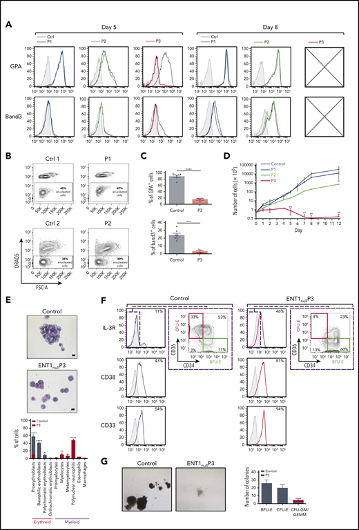 Ex vivo erythroid differentiation of CD34+ from ENT1null patients. (A) Erythroid differentiation of CD34+ progenitors was evaluated following rEPO-induced differentiation as a function of expression of the erythroid surface markers GPA and Band3. Representative histograms showing the differentiation of CD34+ progenitors from P1 (blue), P2 (green), P3 (red), controls (black), and nonspecific immunoglobulin G (IgG) staining (gray shaded) are presented at days 5 and 8 of differentiation. Crossed boxes are present when insufficient cells were available for analyses. (B) Enucleation of erythroblasts from P1 and P2 ENT1null patients and respective controls (Ctrl1 and Ctrl2) was monitored at day 12 of erythroid differentiation as a function of DRAQ5 staining. Representative fluorescence-activated cell sorting plots and the percentages of enucleated cells (DRAQ5−) are shown. (C) The percentages of GPA+ cells and Band3+ cells were quantified at day 5 of differentiation. Mean percentages ± standard error of the mean for controls (black dots, n = 7 independent experiments) and P3 ENT1null patient progenitors (red triangles, n = 2 independent experiments in duplicate) are presented. ****P < .0001; ***P = .0002 (unpaired Student t test). (D) Growth curves of progenitors from the 3 ENT1null patients (P1, n = 1; P2, n = 1; P3, n = 4) and healthy donors (n = 9) were evaluated at indicated days of erythroid differentiation. **P < .01 (unpaired Student t test). (E) Representative images of MGG-stained Cytospins at day 5 of rEPO differentiation of control and P3 ENT1null progenitors are shown (top). The bar represents 10 µm. Quantification of the different cell types is presented (n = 3 independent experiments, bottom). (F) Characterization of P3 and control progenitors were evaluated at day 7 of the expansion phase (before addition of rEPO) as a function of IL-3R, CD34, CD36, CD38, and CD33. Representative histograms showing nonspecific IgG staining (gray shaded), control (black line) and P3 (red line) staining are presented. The expression of CD34 and CD36 surface markers was analyzed on the IL-3Rneg cells to identify burst-forming unit erythroid (IL-3R−CD34+CD36−, green square) and CFU-E (IL-3R−CD34−CD36+, red square) and representative percentages are indicated. (G) CD34+ progenitor cells from a healthy donor and the P3 ENT1null patient were cultured in a methylcellulose semisolid culture assay and representative images of the generated colonies are shown. Quantification of the generated colonies is presented for 2 technical replicates.