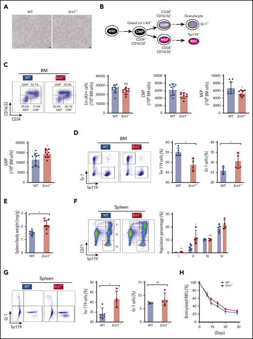 Genetic depletion of Ent1 in mice hampers erythroid lineage commitment in the BM. (A) Increased size of RBCs in Ent1−/− mice compared with WT mice. EDTA-anticoagulated mouse blood was used for Wright-Giemsa staining and representative blood smears are shown. (B) Schematic of MEP, CMP, and GMP progenitors as well as the differentiation to mature red cells and granulocytes. The flow cytometry-based analytic strategy to identify the different populations is presented. (C) Representative FACS analysis of hematopoietic progenitor cells of BM of 8- to 12-week-old Ent1−/− and WT mice. The number of Lin−cKit+, CMP, MEP, and GMP cells per 106 BM cells (excluding RBCs) are presented in WT and Ent1−/− mice (n = 9, *P < .05). (D) Erythroid and myeloid cells were evaluated as a function of Ter119 and Gr-1 staining, respectively, and representative dot plots are shown (left). Quantification of the percentages of Ter119+ cells vs Gr-1+ cells in BM of Ent1−/− and WT mice are presented (right) as means ± standard error of the mean (SEM) with each point corresponding to data from 1 mouse (*P < .05). (E) Quantification of spleen body weight ratio in Ent1−/− and WT mice (*P < .05). (F) Representative FACS analyses of differentiated erythroblasts by CD71 and Ter119 staining in spleens of Ent1−/− and WT mice (left). The developmental stage of erythroblasts was indicated by populations I, II, III, and IV. The quantification of these populations is displayed on the right (*P < .05). (G) Representative FACS plots are shown for splenic Ter119+ cells vs Gr-1+ cells in Ent1−/− and WT mice (left) and quantification of data in individual mice are presented as means ± SEM (right; *P < .05). (H) Biotin-labeled RBCs in WT (black circles) and Ent1−/− (red squares) are shown as a function of time after biotin labeling. Means ± SEM of 5 mice in each group are shown.