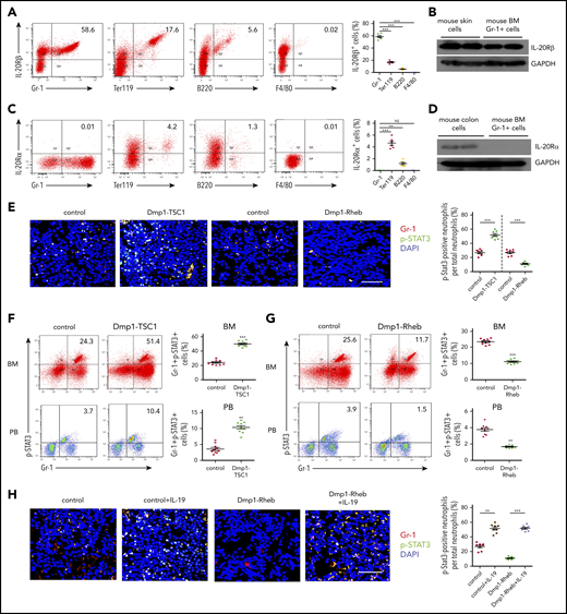 IL-19 promotes granulopoiesis through IL-20Rβ/STAT3 signaling. (A) FACS analysis of IL-20Rβ levels in Gr-1+, Ter119+, B220+, and F4/80+ cells in the BM of 12-week-old mice (mean ± SD; n = 6). (B) Expression levels of IL-20Rβ in skin cells and BM Gr-1+ cells in 12-week-old mice were detected by western blotting. (C) FACS analysis of IL-20Rα in Gr-1+, Ter119+, B220+, and F4/80+ cells in the BM of 12-week-old mice (mean ± SD; n = 6). (D) Expression levels of IL-20Rα in colon cells and BM Gr-1+ cells in 12-week-old mice were detected by western blotting. (E) Immunofluorescence microscopy of femur sections of 12-week-old Dmp1-TSC1, Dmp1-Rheb, and control mice. Cells were stained with anti–Gr-1 (red) and anti–p-STAT3 (green). Blue, nuclei visualized by DAPI stain. Scale bar, 30 µm. (F) FACS analysis of BM and PB Gr-1+p-STAT3+ cells in 12-week-old Dmp1-TSC1 and control mice (mean ± SD; n = 10). (G) FACS analysis of BM and PB Gr-1+p-STAT3+ cells in 12-week-old Dmp1-Rheb and control mice (mean ± SD; n = 10). (H) Immunofluorescence microscopy of femur sections of 12-week-old Dmp1-Rheb and control mice IP injected with recombinant murine IL-19 (25 µg/kg per day) for 14 days. Cells were stained with anti–Gr-1 (red) and anti–p-STAT3 (green). Blue, nuclei visualized by DAPI stain. Scale bar, 30 µm. (I) FACS analysis of BM and PB Gr-1+p-STAT3+ cells in recombinant IL-19–treated 12-week-old mice (mean ± SD; n = 10). (J) Dmp1-TSC1 and control mice with bilateral intratibial injection into the marrow cavity with IL-20Rβ or negative control (NC) siRNAs for 10 days. The efficiency of IL-20Rβ siRNAs for IL-20Rβ in BM cells was measured by western blotting. (K) FACS analysis of BM and PB CD11b+Gr-1+ cells in IL-20Rβ siRNA-treated 12-week-old mice (mean ± SD; n = 10). (L) Immunofluorescence microscopy of femur sections of 12-week-old Dmp1-TSC1 and control mice treated with IL-20Rβ or NC siRNAs. Cells were stained with anti–Gr-1 (red) and anti–p-STAT3 (green). Blue, nuclei visualized by DAPI stain. Scale bar, 30 µm. (M) FACS analysis of BM and PB Gr-1+p-STAT3+ cells in 12-week-old Dmp1-TSC1 and control mice treated with IL-20Rβ or NC siRNAs (mean ± SD; n = 10). Data are mean ± SD of 3 independent experiments. **P < .01; ***P < .001. GAPDH, glyceraldehyde-3-phosphate dehydrogenase.