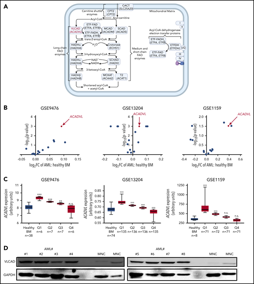 ACADVL is overexpressed in human AML. (A) Schematic diagram of the FAO pathway highlighting enzymes associated with the carnitine shuttle; long, medium, and short chain FAO; and ACAD electron transfer with the protein VLCAD, coded by the gene ACADVL (in red). Enzyme names are in roman type; corresponding gene names (beneath the protein name) are italicized. Each enzyme’s full name, short form name, and encoding gene are shown in supplemental Figure 1A. UQ, I, II, III, and IV are abbreviations for ubiquinone and complexes 1, 2, 3, and 4 of the ETC. Created using BioRender. (B) Volcano plots comparing the fold change in the expression of various intramitochondrial FAO genes between AML patient and healthy BM populations in the GSE9476, GSE13204, and GSE1159 data sets. (C) ACADVL gene overexpression between AML patient and healthy BM populations in GSE9476, GSE13204, and GSE1159. AML populations were stratified into quartiles, labeled Q1 through Q4. In (B) and (C), comparisons between genes are presented as a scatter plot with the x-axis as log2 of the fold change and the y-axis as a negative log10 of the P value for AML vs healthy BM populations. (D) Immunoblot showing VLCAD protein levels across patient-derived AML cells (#1-#8, where the number after # denotes the patient ID), isolated from peripheral blood, and normal MNCs. Patient cytogenetics are in supplemental Figure 10. **P ≤ .002, ***P ≤ .001, 2-tailed unpaired Student t test. n.s., not significant.