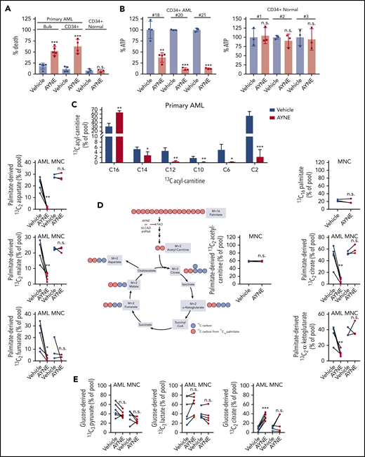 AYNE inhibits palmitate contribution to the TCA cycle, resulting in primary AML cell death while sparing normal cells. (A) Viability of primary bulk AML cells (#14-#18), primary CD34+ AML cells (#2, #3, #15, #19), and normal CD34+ cells (n = 3) treated for 24 hours. (B) Quantification of ATP levels in primary CD34+ AML and CD34+ normal cells after 12-hour treatment. (C) Levels of 13C-labeled ACs in primary AML cells (#4, #22, #23, #24, #27) after 12 hours. (D) Enrichment of 13C atoms into FAO and TCA metabolites following 12-hour treatment with a uniformly labeled 13C16 palmitate tracer in primary AML cells (#4, #22, #23, #24, #27) and normal MNCs (n = 3). Created using BioRender. (E) Levels of 13C3 lactate, 13C3 pyruvate, 13C2 citrate following 12-hour treatment with a 13C6 glucose tracer in primary AML cells (#3, #15, #16, #19, #25, #26) and normal MNCs (n = 5). In all experiments, primary AML cells and normal MNCs were treated with a solvent vehicle or 50 µM AYNE. In (A-E), data are mean ± standard deviation. Summary of patient cytogenetics are shown in supplemental Figure 10. Summary of statistics for (C-E) are shown in supplemental Figure 11. *P ≤ .05, **P ≤ .002, ***P ≤ .001, 2-tailed unpaired Student t test. shRNA, short hairpin RNA.