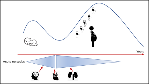Presentation and acuity of congenital TTP. There is a bimodal distribution of presentation, in the neonatal period/early childhood and early adulthood, increased in women of child-bearing age. Acute TTP episodes are more common in children (<18 years) and organ involvement (brain, heart, and kidneys) with permanent end organ damage related to delayed cTTP diagnosis from presentation. The international registry does not document an increase in acute TTP episodes with age, but there does appear to be a higher risk of end organ damage when they occur.