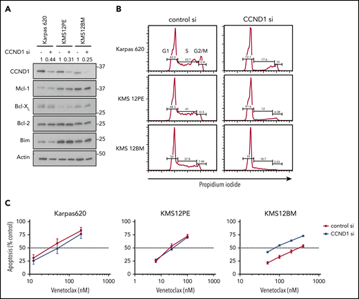 CCND1 knockdown does not induce resistance to venetoclax. (A) Protein lysates were prepared from cells 72 hours after nucleoporation with either control siRNA or CCND1 siRNA. Protein was subjected to sodium dodecyl sulfate–polyacrylamide gel electrophoresis and western blotting for CCND1, MCL1, BCLXL, BCL2, BIM, and ACTIN. Densitometry quantification of CCND1 relative to control siRNA and normalized to actin is shown for each cell line. (B) The same cells were fixed, permeabilized, and stained with propidium iodide to measure DNA content. Gates depict percentage of cells in G1, S, and G2/M. (C) Starting at 48 hours after siRNA nucleoporation, cells were treated with indicated doses of venetoclax for 24 hours followed by staining with Annexin V–fluorescein isothiocyanate to measure apoptosis. Data are presented as the mean ± standard error of 3 independent experiments.