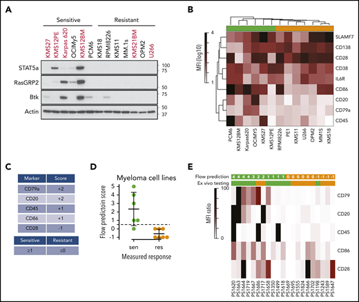 Expression of B-cell genes in venetoclax-sensitive myeloma patient samples. (A) Western blot of STAT5A, RASGRP2, BTK, and ACTIN in a subset of cell lines. (B) Heat map representing mean fluorescent intensity (MFI) of cell surface markers averaged from 3 independent experiments. Sensitive (green) and resistant (orange) cell lines are denoted by colored boxes above the heat map. (C) Scoring system for flow-based markers. (D) Application of scores to myeloma cell lines from panel B. The dashed line represents the cutoff for sensitivity vs resistance. (E) Heat map of cell surface marker expression in patient samples. The top row of green (sensitive) and orange (resistant) boxes denotes the flow-based score and prediction for venetoclax response. The second row of boxes represents the prediction from ex vivo testing.