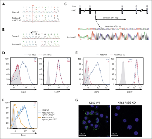 Mutations in the PIGG gene are responsible for the Emm-negative blood group. (A-B) Sanger sequencing of PIGG mutations found in Emm-negative proband 1 and proband 2, respectively. (C) Schematic representation of the deletion in the PIGG gene and Sanger sequencing of Emm-negative proband 3. (D) Cell surface expression of the Emm antigen and CD59 in control RBCs (Ctrl RBCs) and Emm-negative RBCs (Emm- RBCs). The gray profile corresponds to RBCs incubated with only the secondary antibody. (E) Cell surface expression of the Emm antigen and CD59 in K562 WT and K562 PIGG KO cells. The gray profile corresponds to K562 cells incubated with only the secondary antibody. (F) Surface level of Emm antigen in K562 PIGG KO cells stably transfected with WT PIGG cDNA or mutant PIGG cDNA (c.640C>T; p.H214Y). The gray profile corresponds to K562 cells incubated with only the secondary antibody. (G) Immunofluorescence analysis of Emm antigen shows the plasma membrane localization of this antigen. Nonpermeabilized WT and PIGG KO K562 cells were stained by using an anti-Emm (green) antibody and 4′,6-diamidino-2-phenylindole (blue).