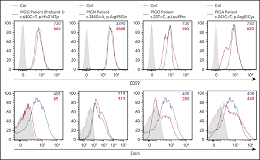 Expression of the Emm antigen vs CD59 in RBCs from IGD patients. Cell surface expression of CD59 (top panel) and the Emm antigen (bottom panel) in RBCs from PIGG (proband 1), PIGA, PIGN, and PIGO patients. The gray profile corresponds to RBCs incubated with only the PE-conjugated anti-mouse (top panel) and anti-human (bottom panel) IgG antibodies.